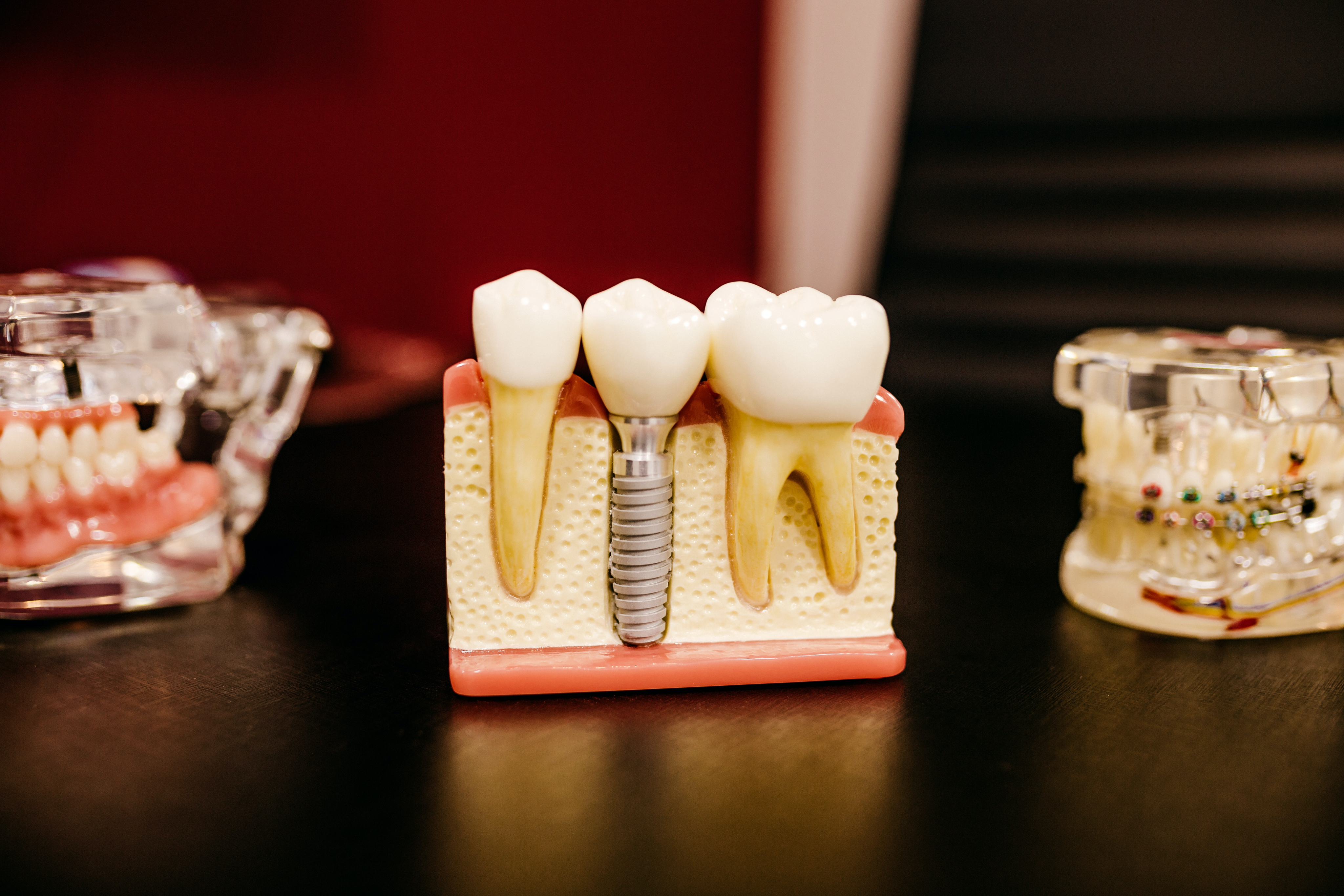 educational teeth display